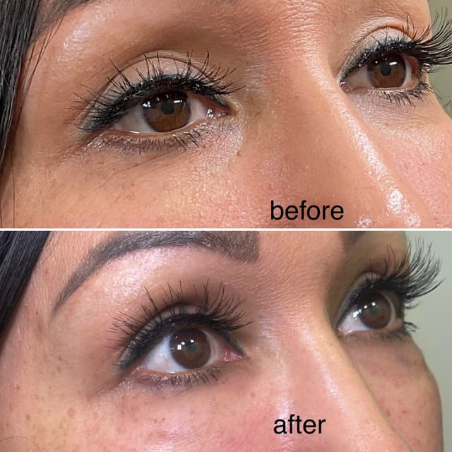PRFM Under Eye Enhancement at Agoddess Spa & Wellness in DeSoto, TX